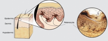 Melanin có phải là nguyên nhân gây sạm da ?